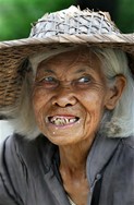 Bad Teeth By Charles Mifsud View Full Portfolio 1040 Images Tags Bad